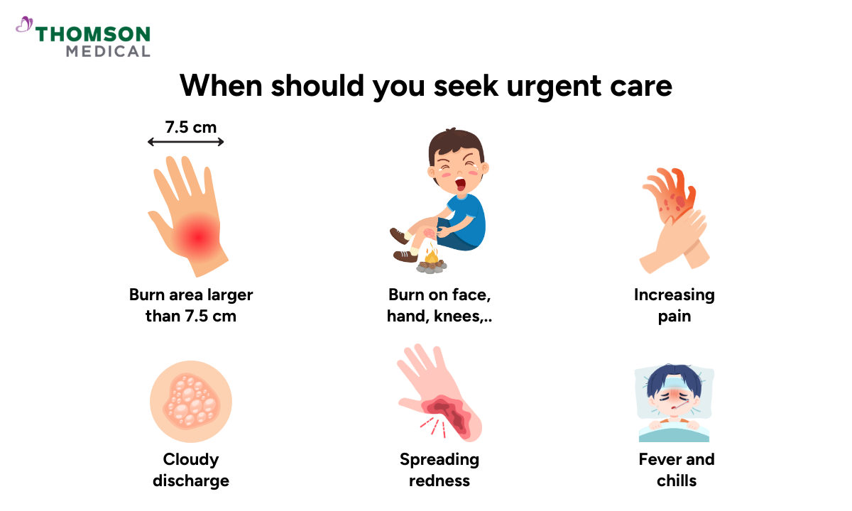 blog-image_ucc_when-to-seek-urgent-care-second-degree-burn.png