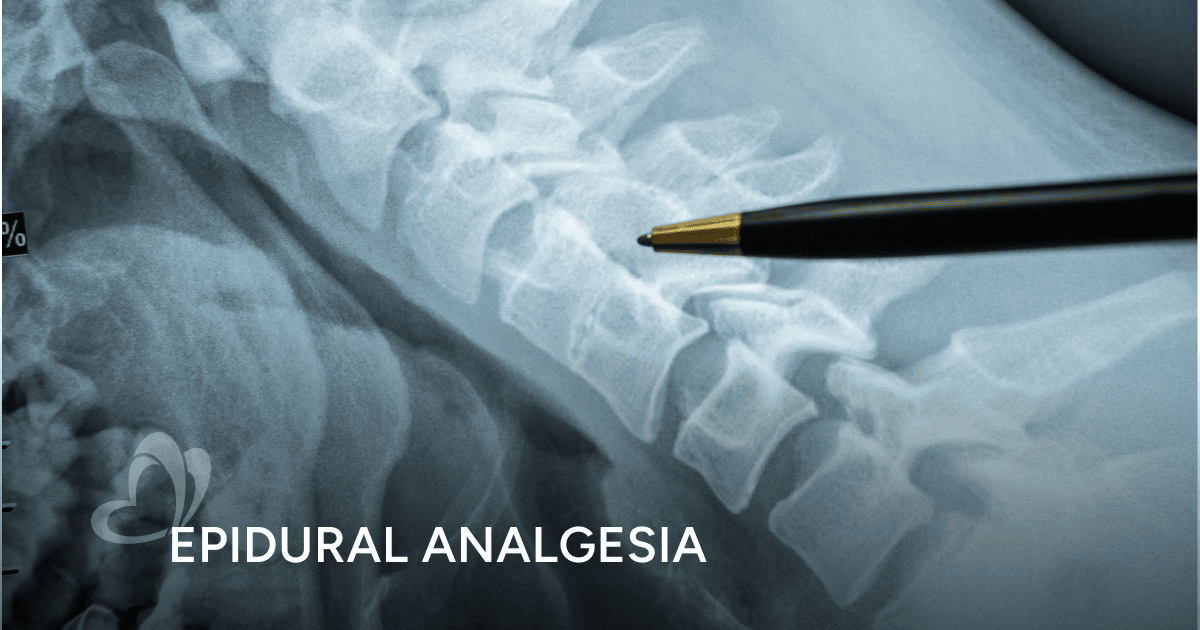 Epidural Analgesia Thomson Medical epidural-analgesia-thomson-medical