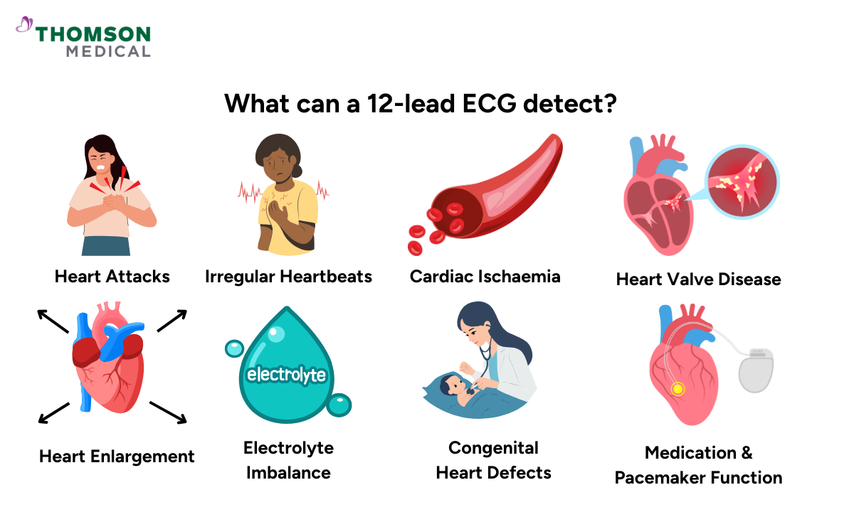 blog-image_screening_12-lead-ecg.png