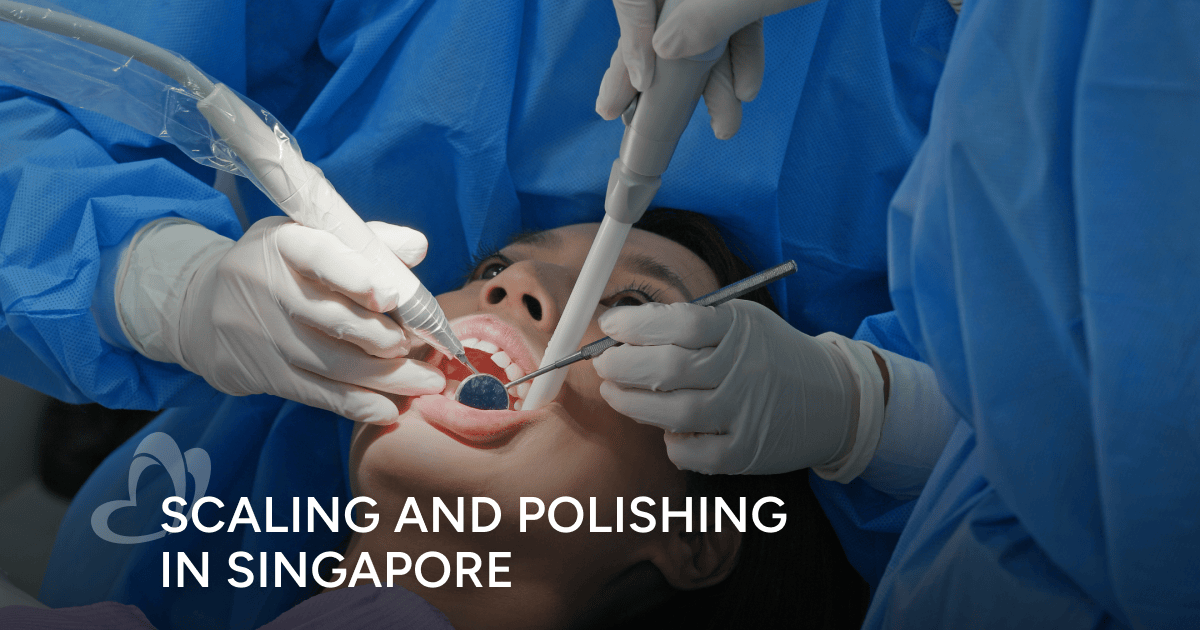 Scaling and Polishing in Singapore Thomson Medical