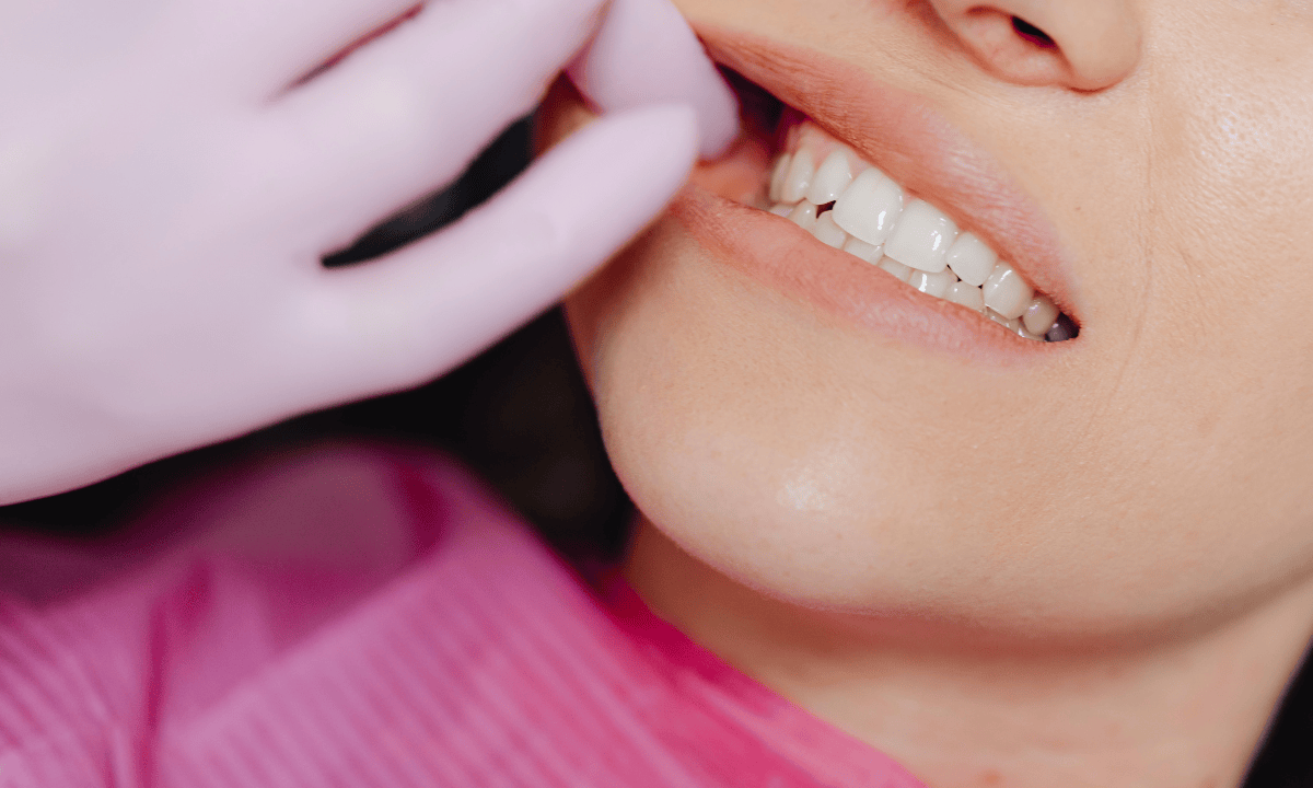 blog-image_dental_crown-lengthening-smile.png