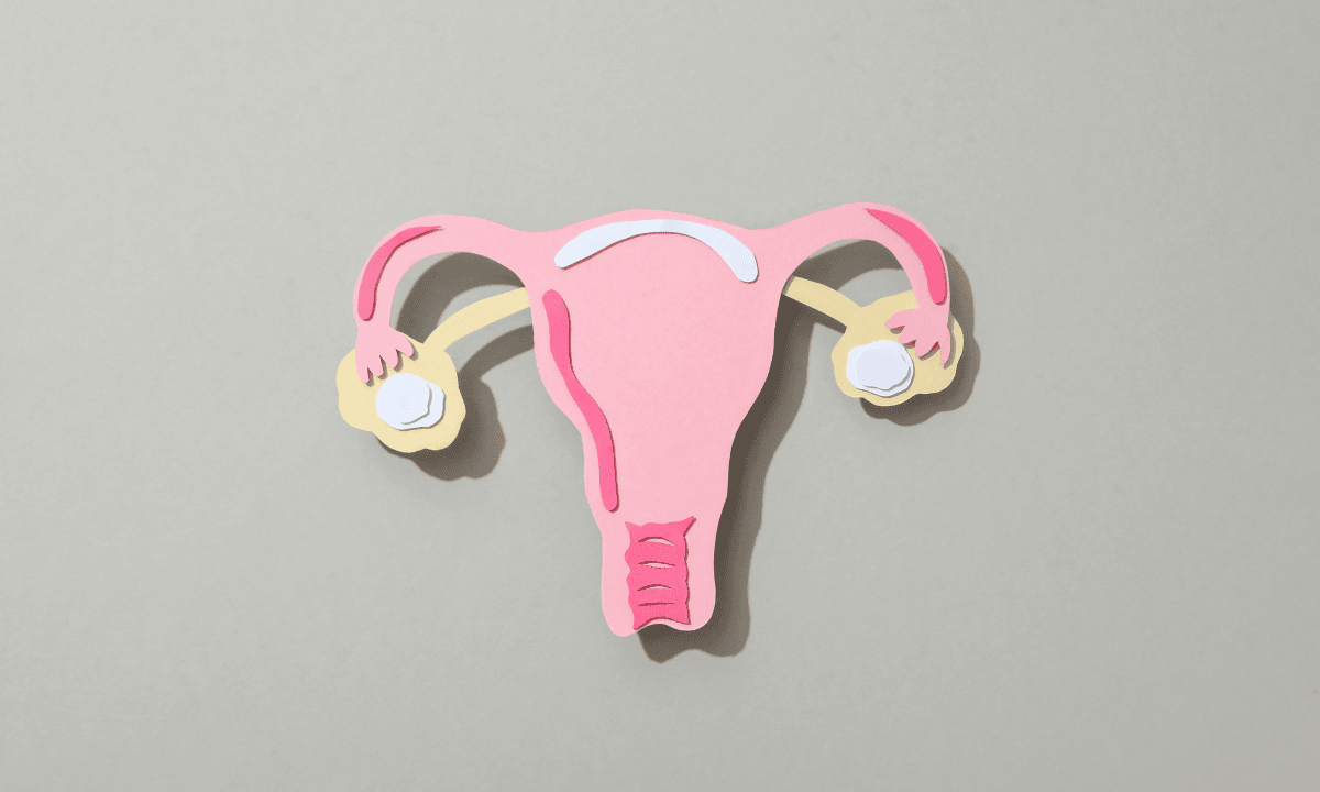 illustration of ovarian cancer