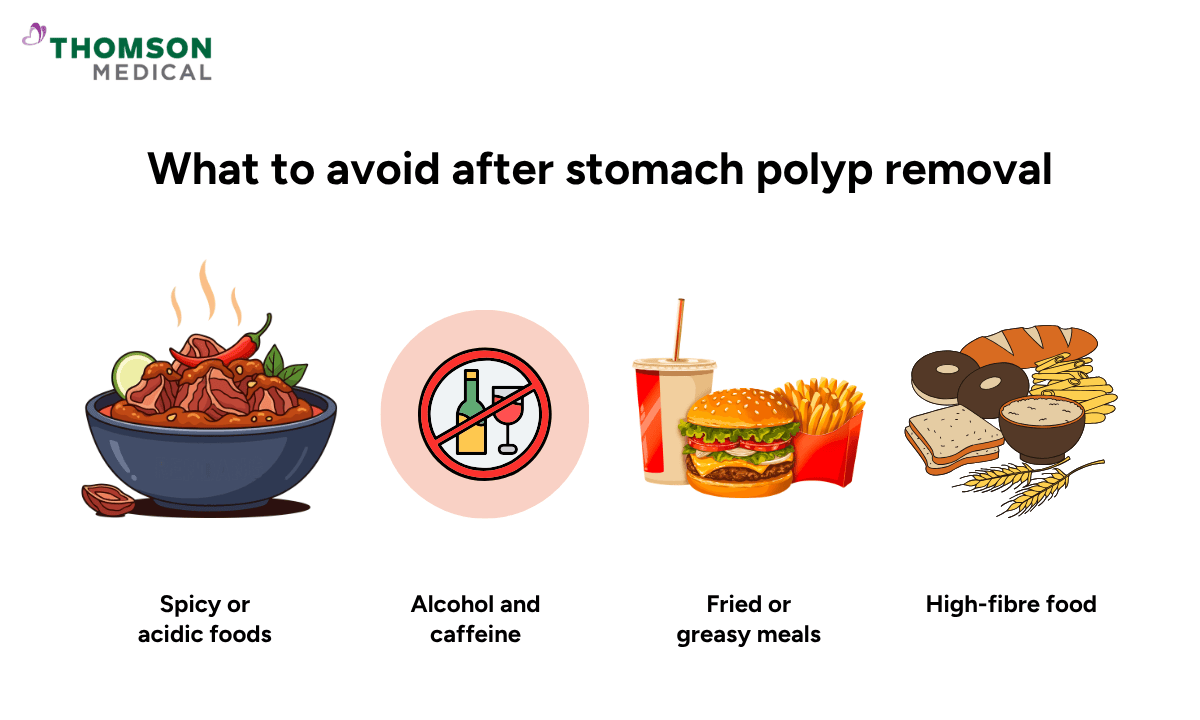 what-to-avoid-after-stomach-polyp-removal