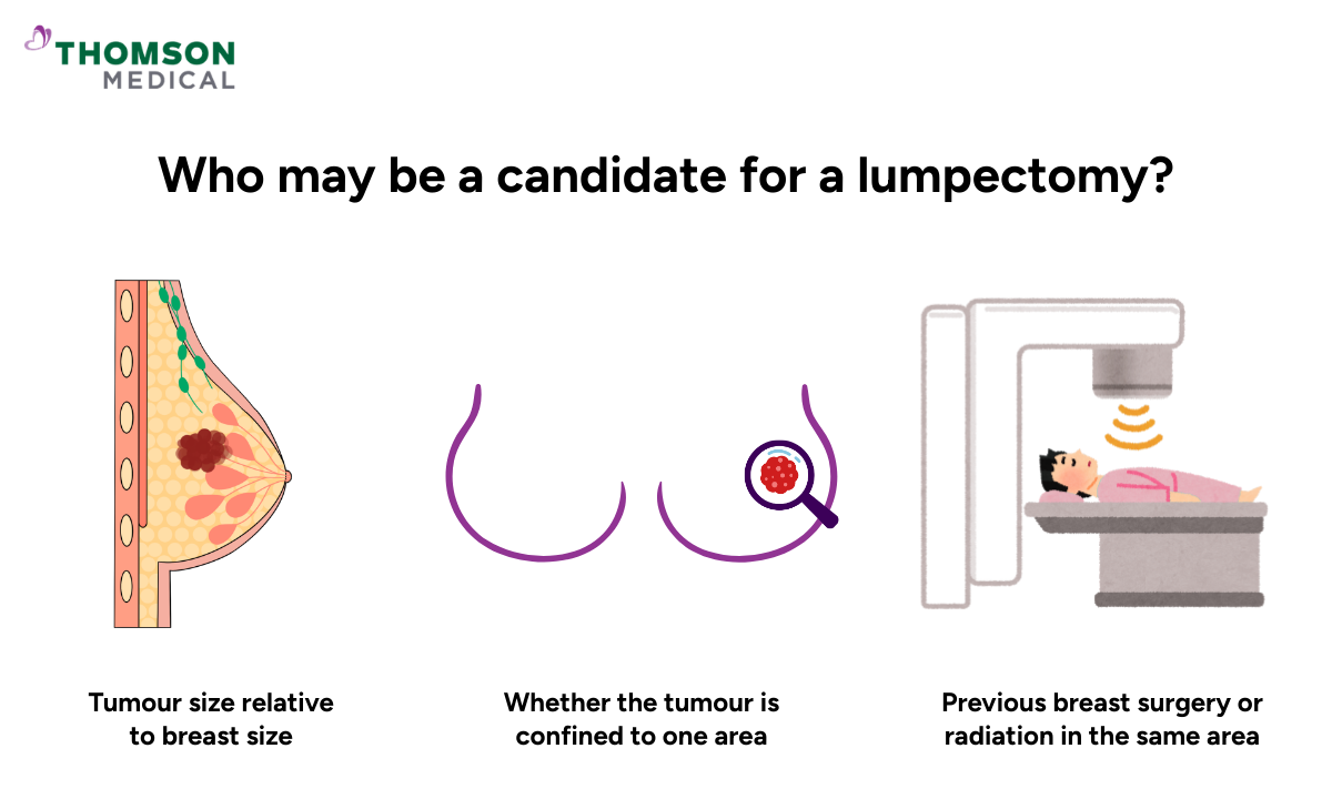 Illustration of who may be a candidate for a lumpectomy