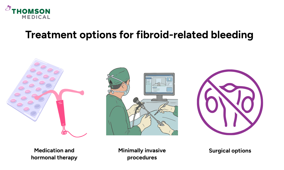 Illustration of the treatment options for fibroid-related bleeding