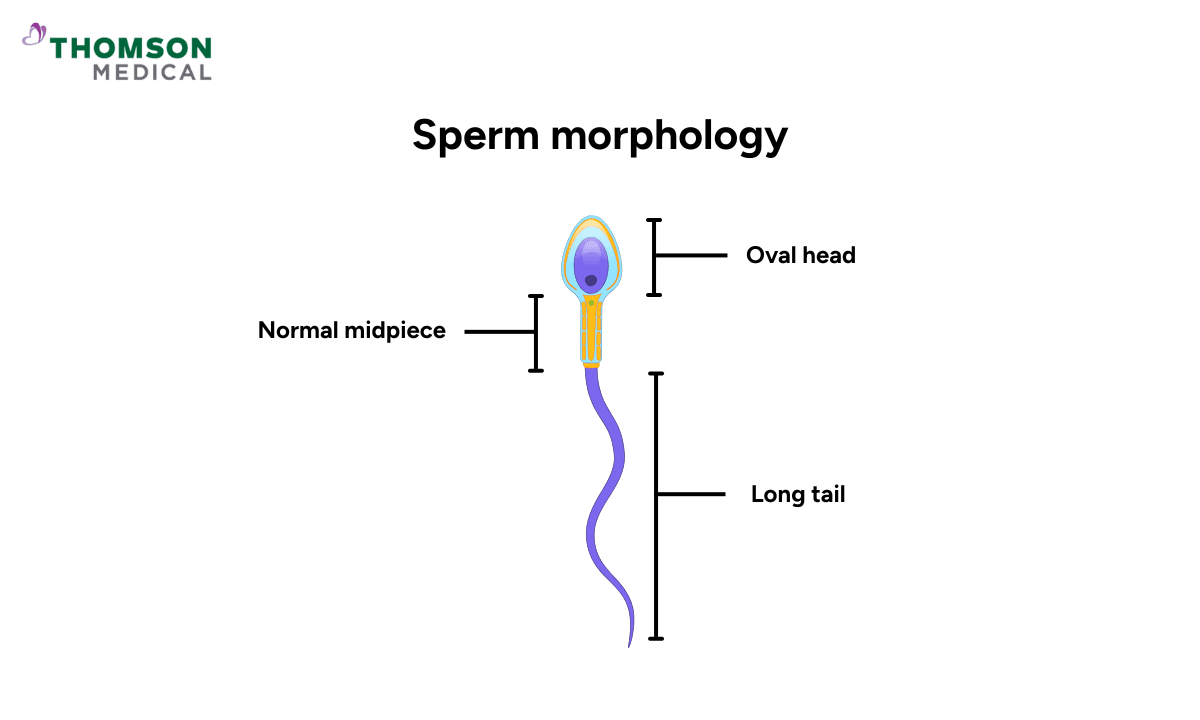 illustration of sperm morphology
