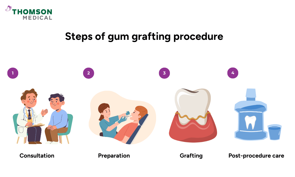 image of steps of gum grafting procedure