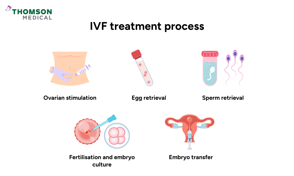 illustration of how IVF treatment works