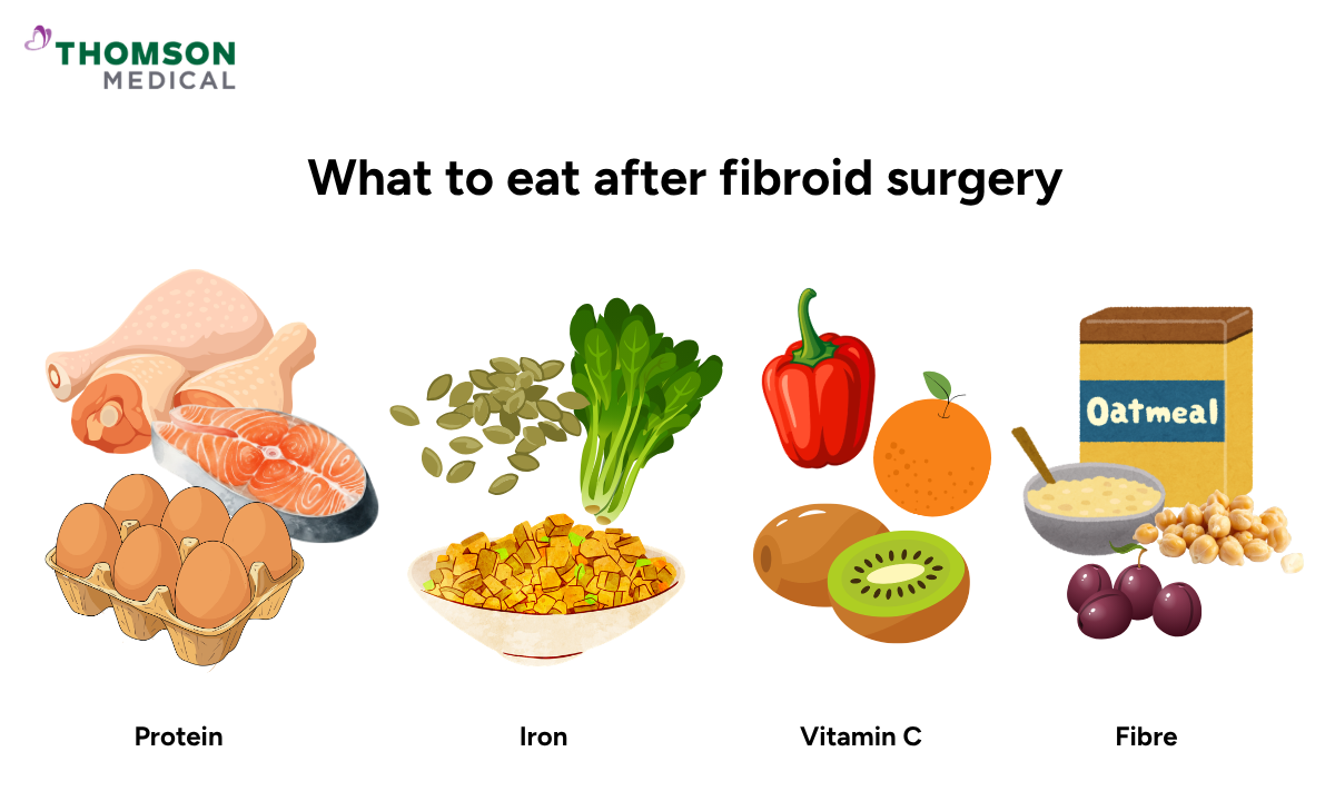 Illustration of what to eat after fibroid surgery
