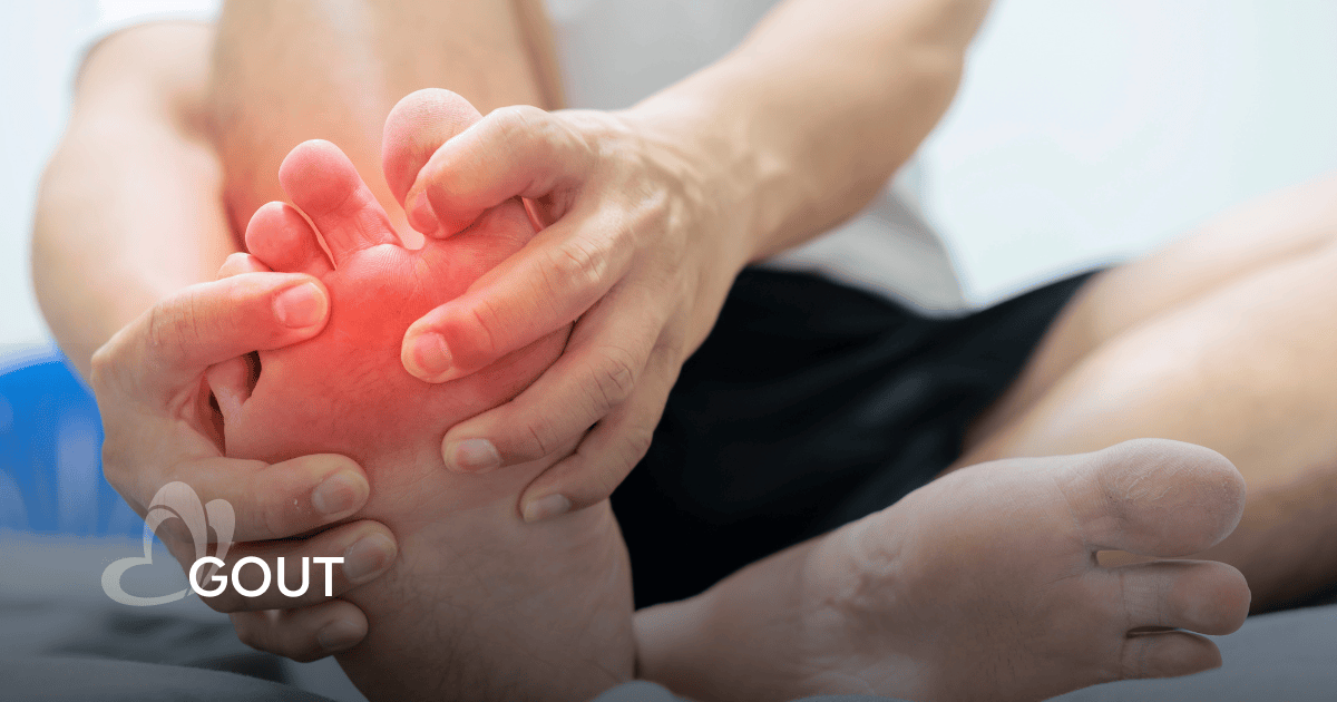 Gout in Foot: Causes, Symptoms, Preventions and Treatments | Thomson ...