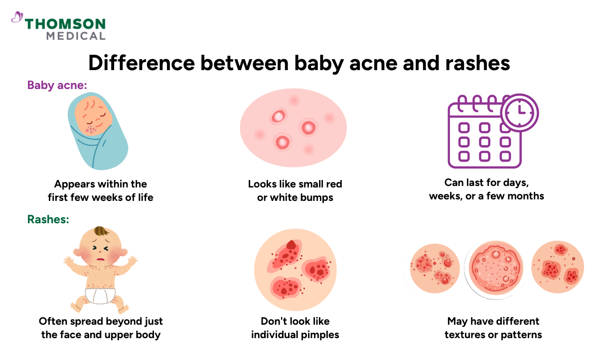 Illustration of the difference between acne and rashes
