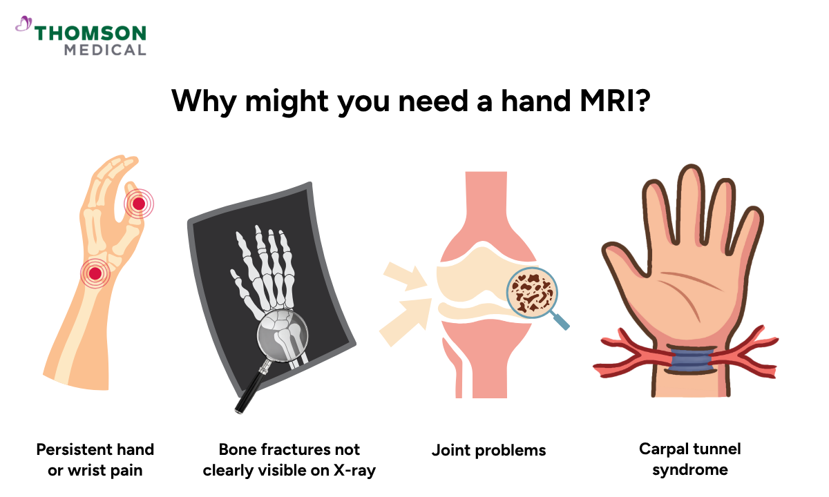 Illustration of why you might need a hand MRI