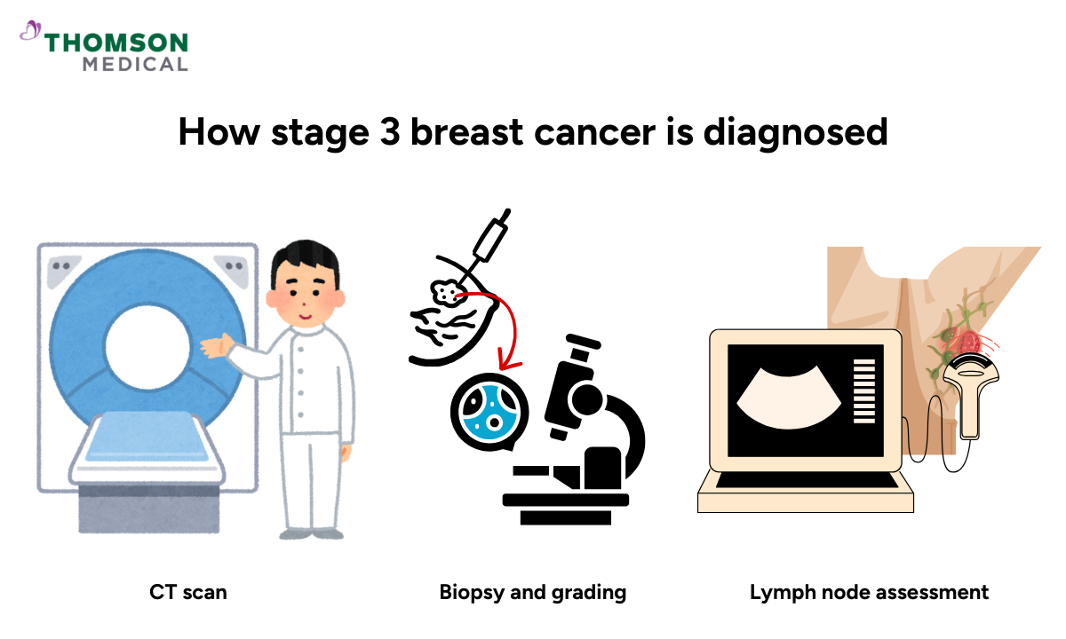 Illustration of how stage 3 breast cancer is diagnosed