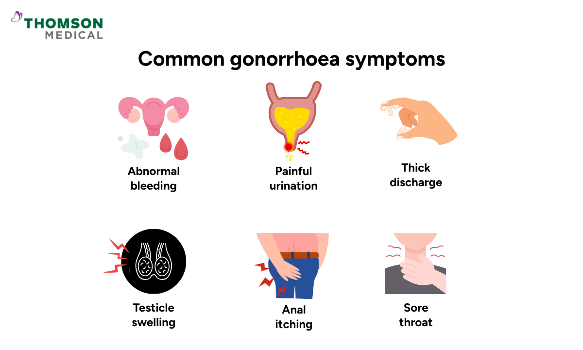 Illustration of common symptoms gonorrhoea symptoms