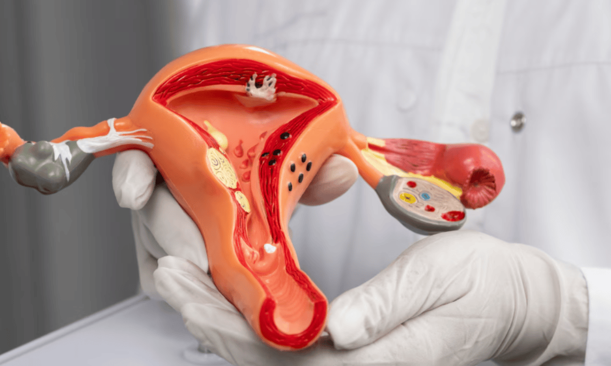 image of endometrial anatomy