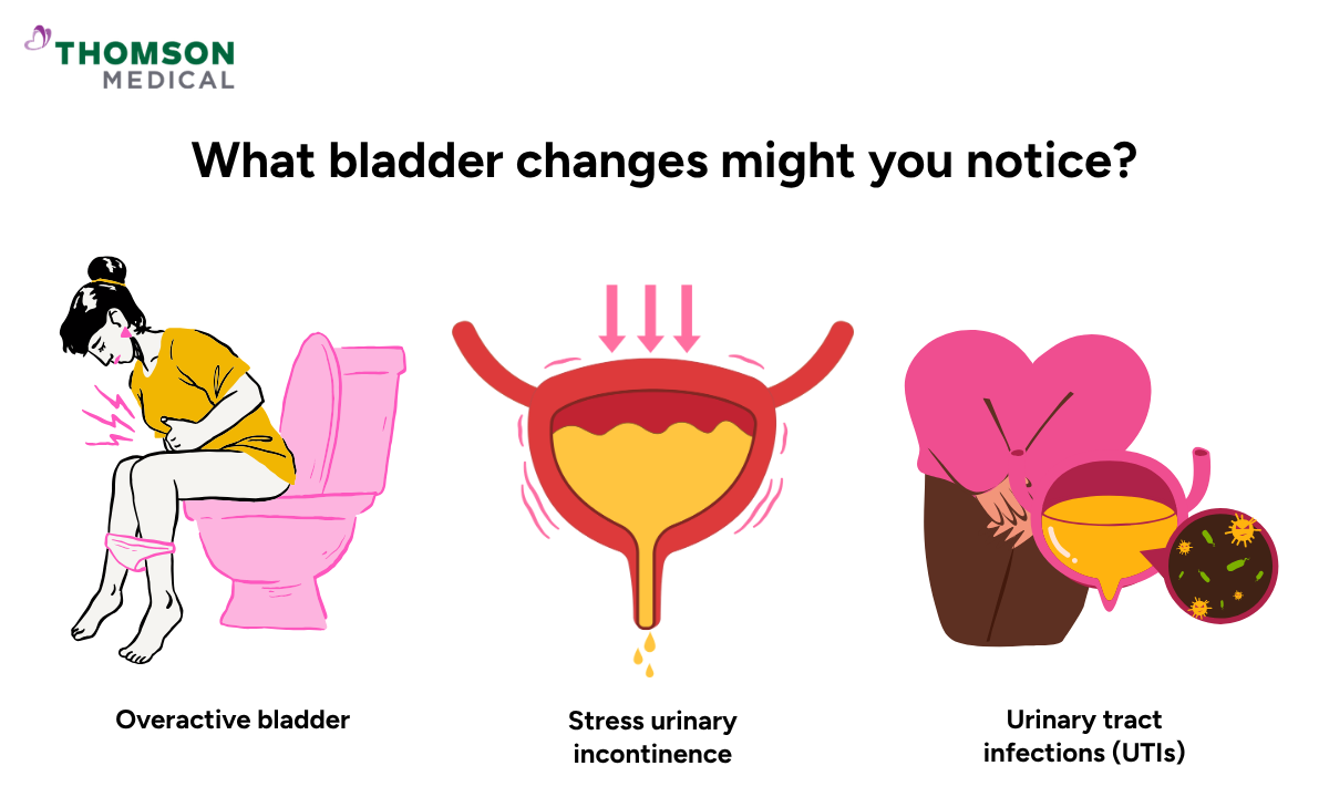 Illustration of what bladder changes you might notice