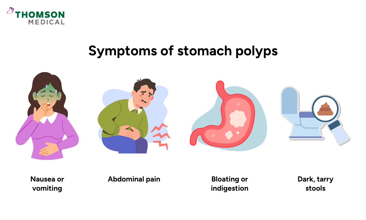 symptoms-of-stomach-polyps