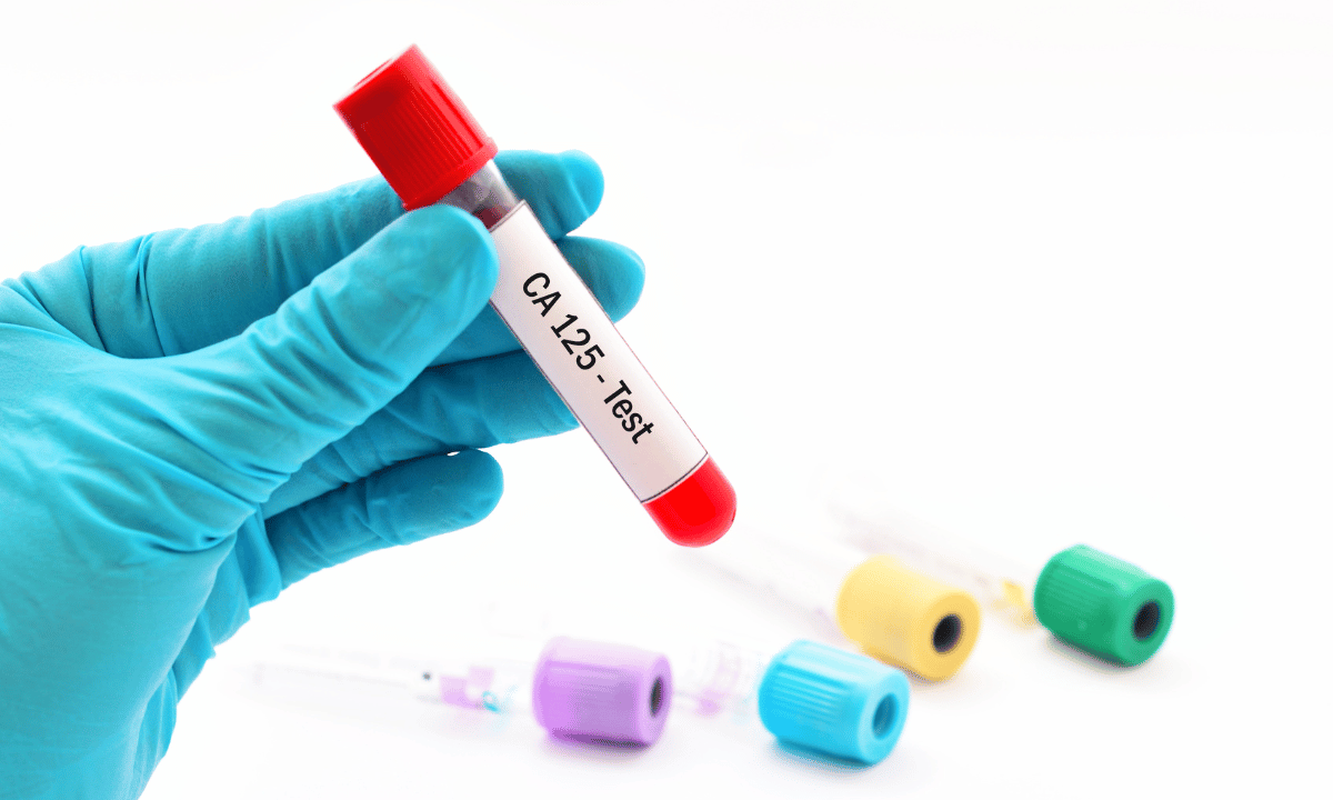 image of a ca-125 blood vial