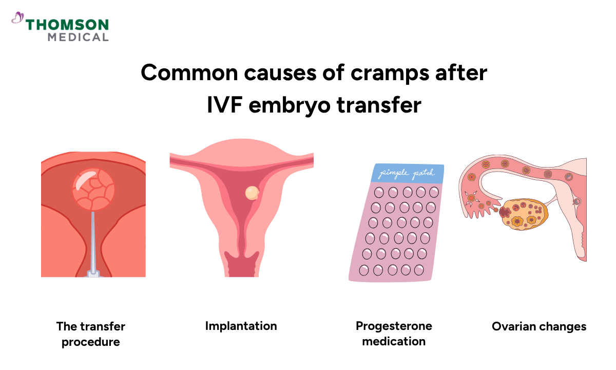 illustration of common causes of cramps after IVF embryo transfer