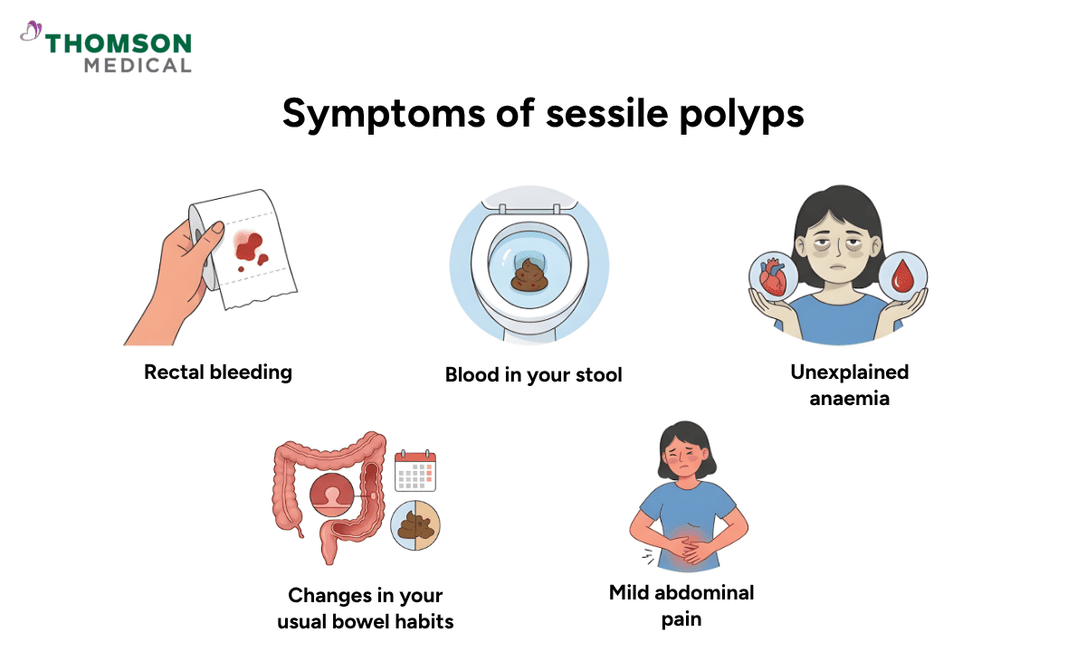 symptoms of sessile polyps