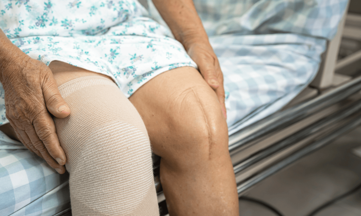 blog-image_orthopaedic_patient-with-knee-replacement.png
