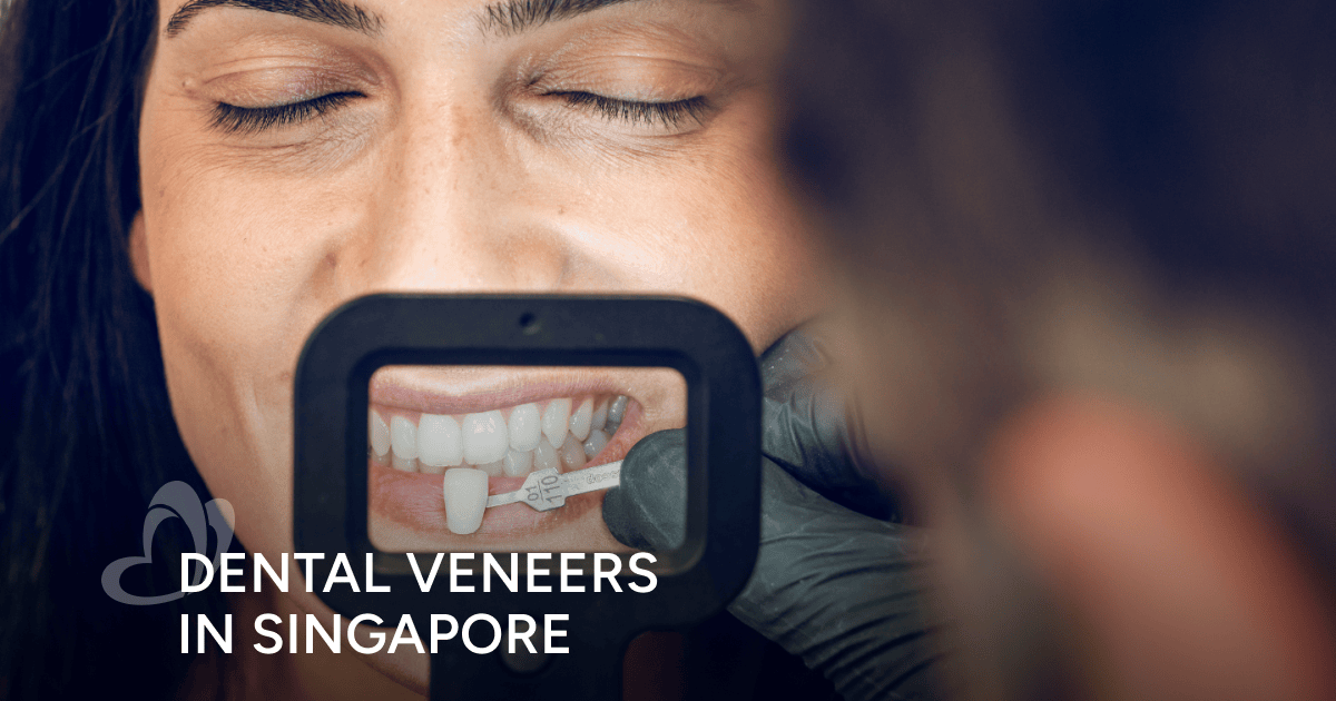 Dental Veneers in Singapore Thomson Medical
