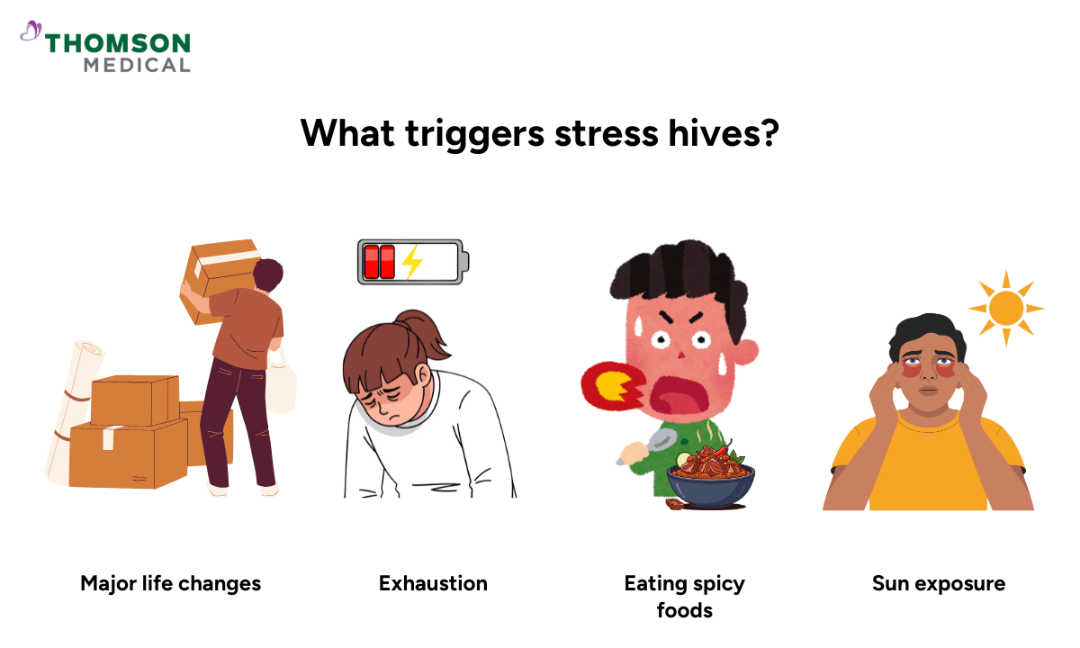 What triggers stress hives