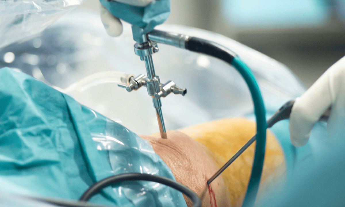 blog-image_orthopaedic_knee-arthroscopy-procedure.png