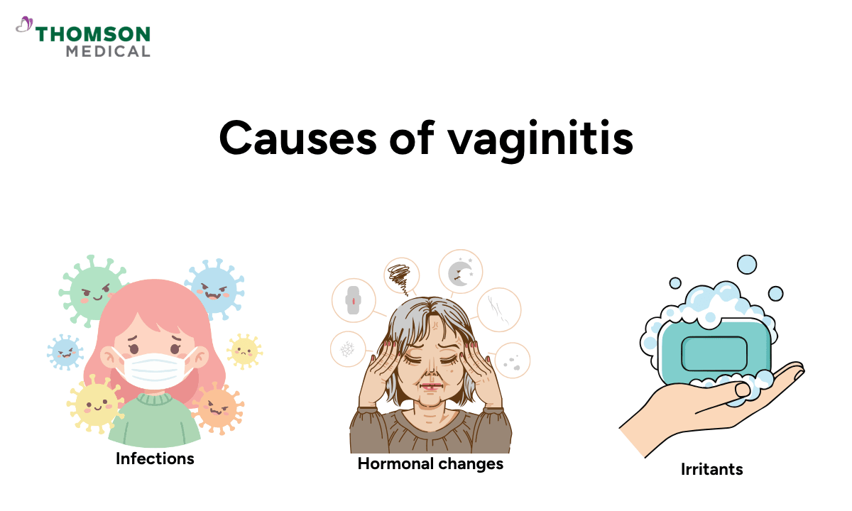 blog-image_obgyn_vaginitis-causes.png