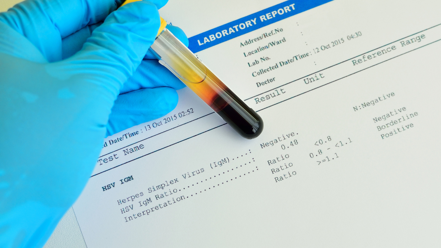 blog-image_obgyn_herpes-testing-cost.png
