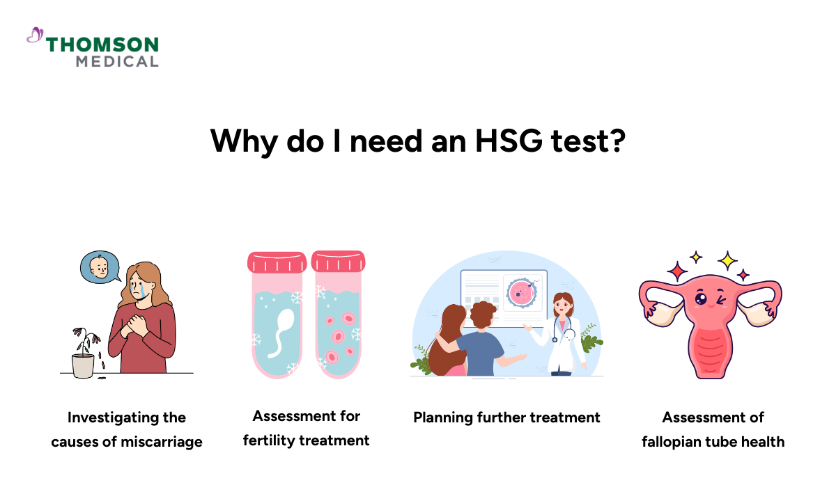 Illustration of why do I need an HSG test