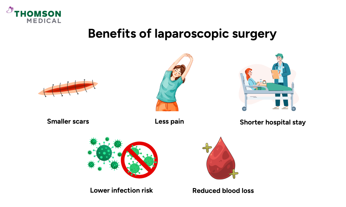 Illustration of benefits of laparoscopic surgery