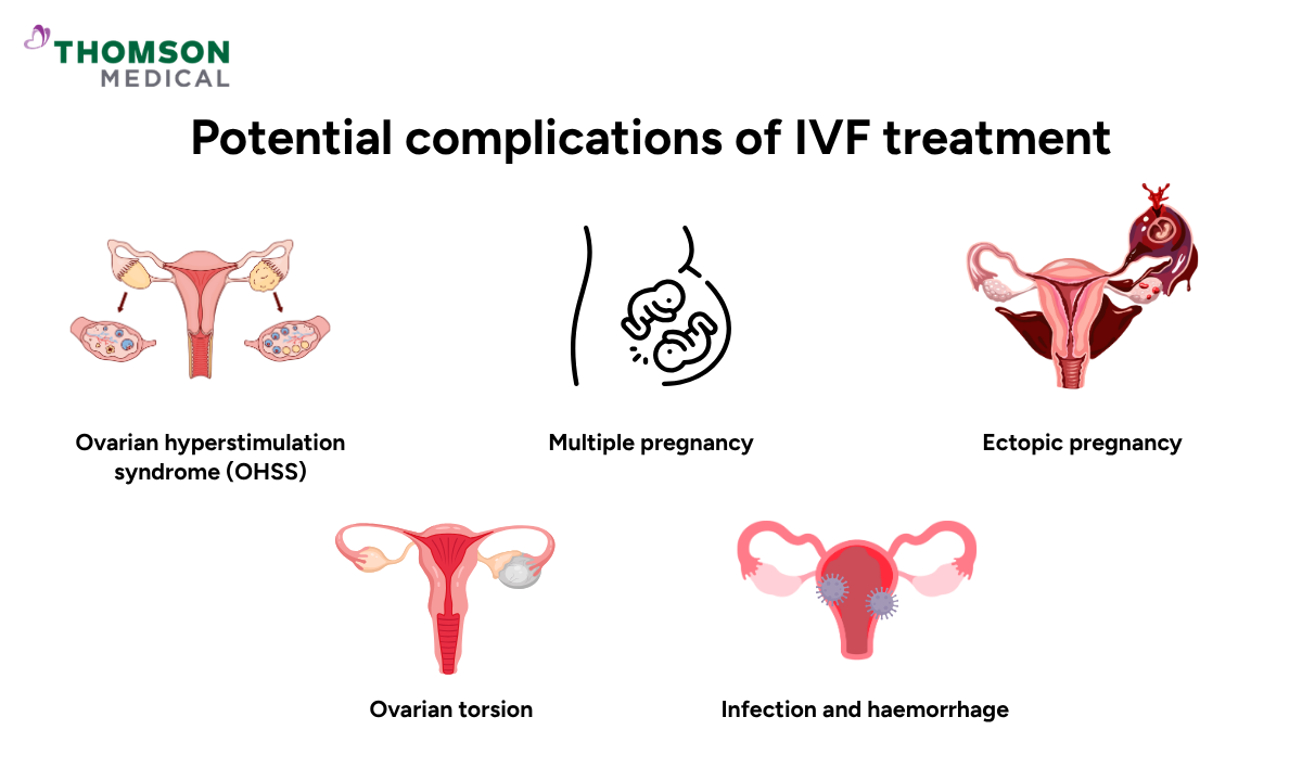 image of IVF potential complications