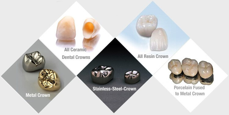 types-of-dental-crown.jpg