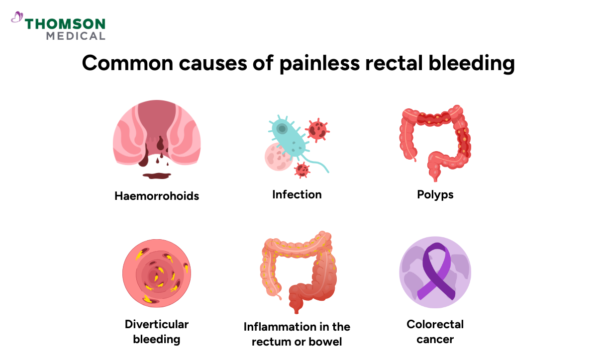 blog-image_ucc_common-causes-of-painless-rectal-bleeding.png
