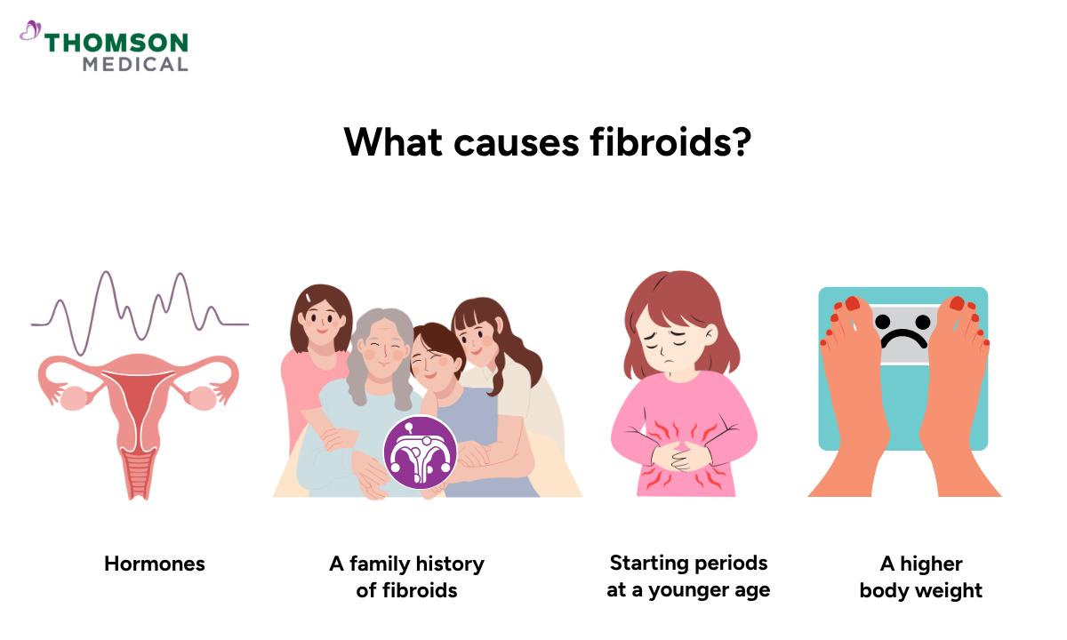 Illustration of the causes of fibroids