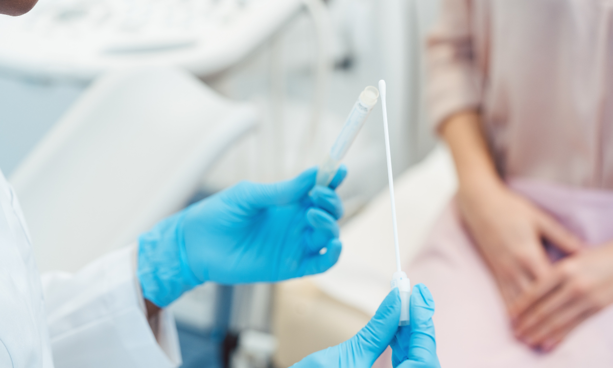 Doctor taking a sample for trichomoniasis from a tube