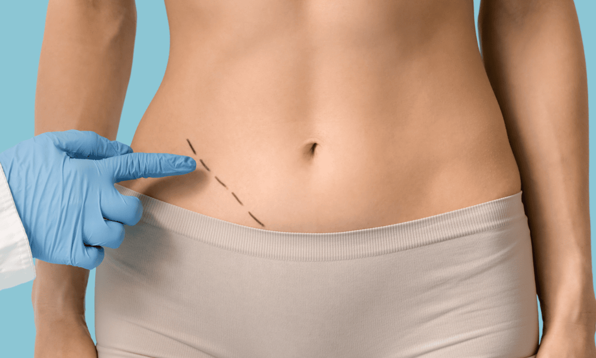 appendicitis-treatments