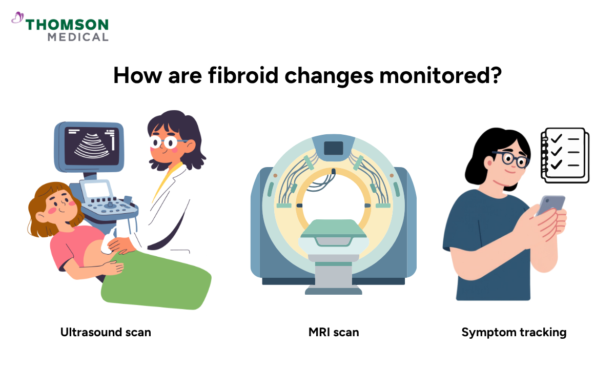 Illustration shows how are fibroid changes monitored