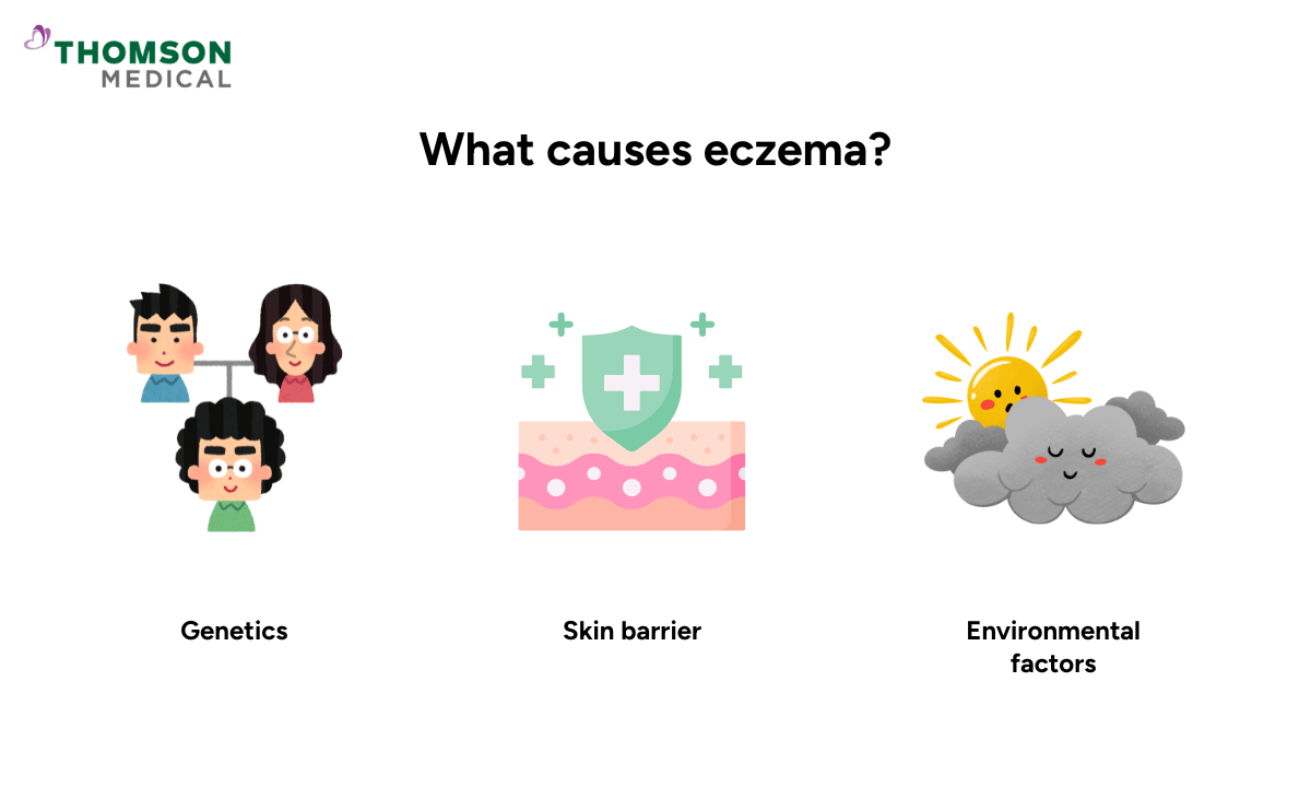 what causes eczema