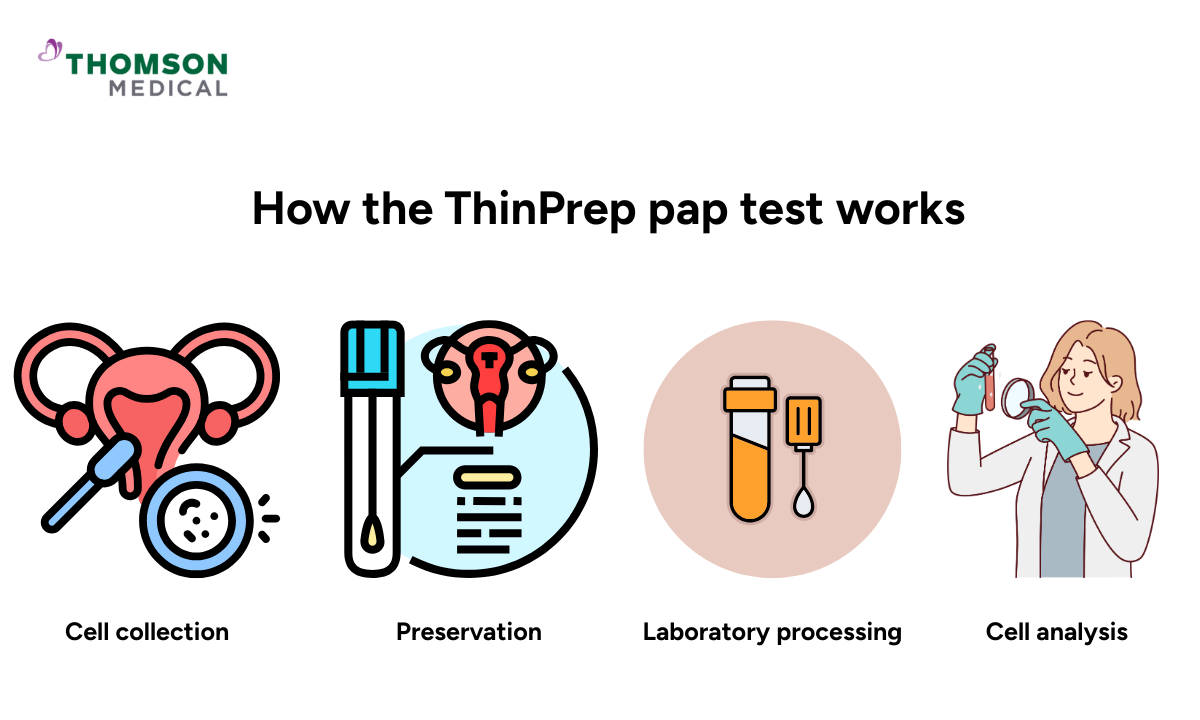 blog-image_screening_thinprep-pap-test-works.png
