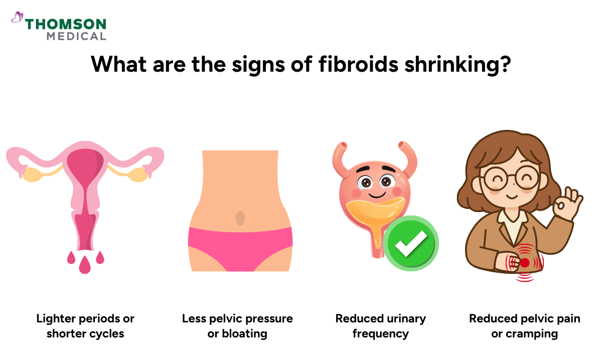 Illustration shows the signs of fibroids shrinking