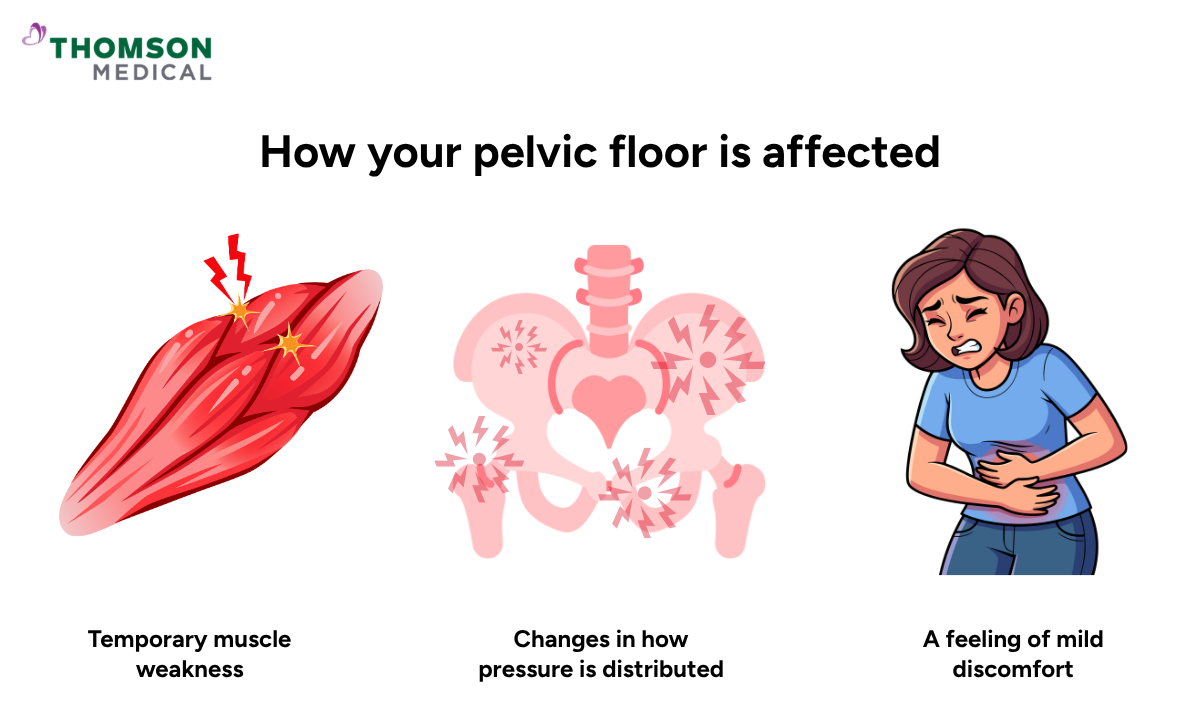 Illustration of how your pelvic floor is affected
