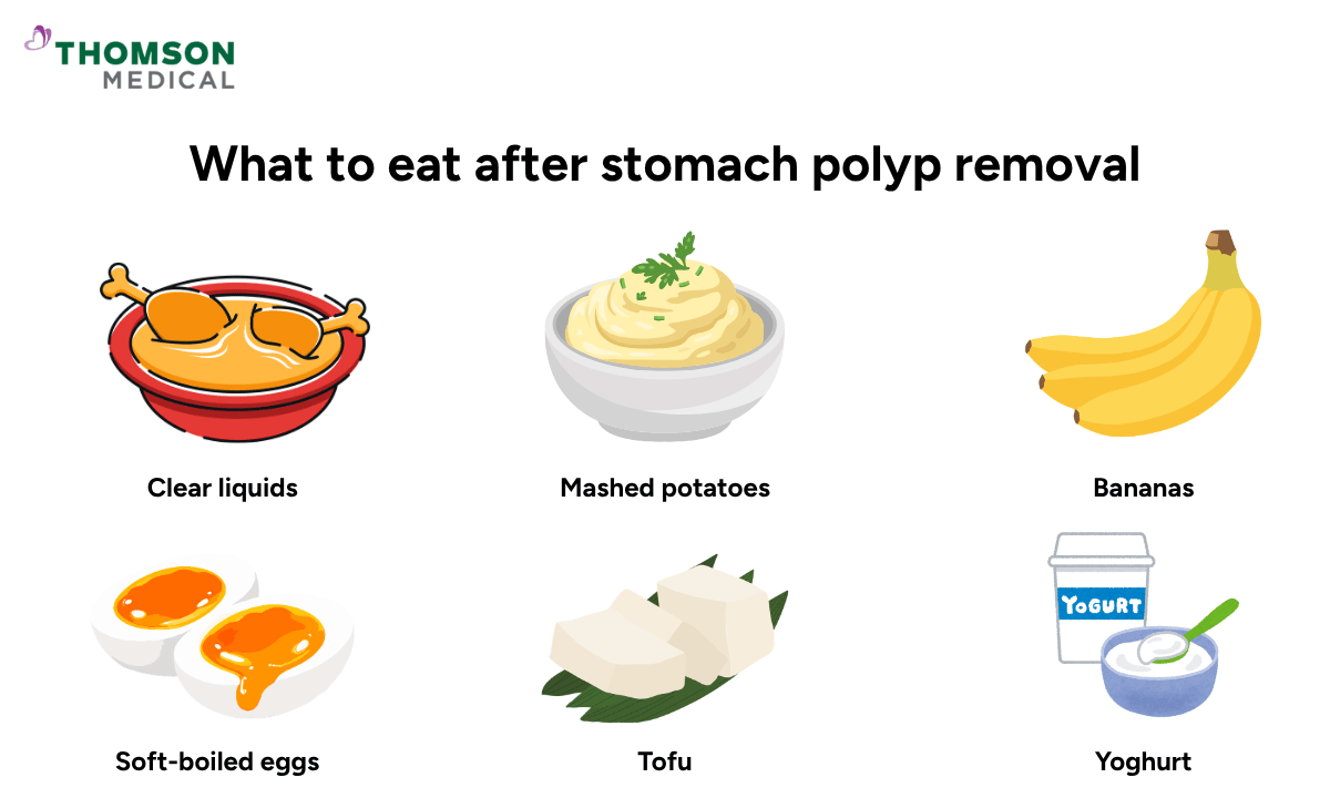 what-to-eat-after-stomach-polyp-removal
