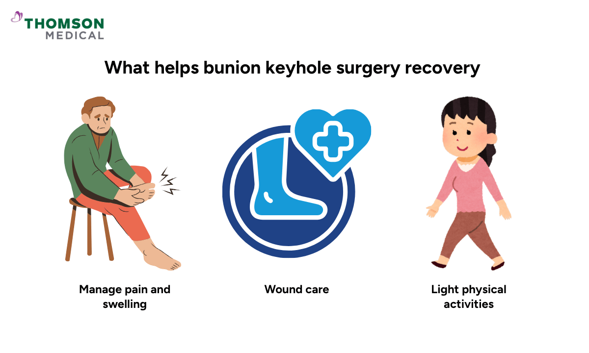 Illustration of what helps bunion keyhole surgery recovery