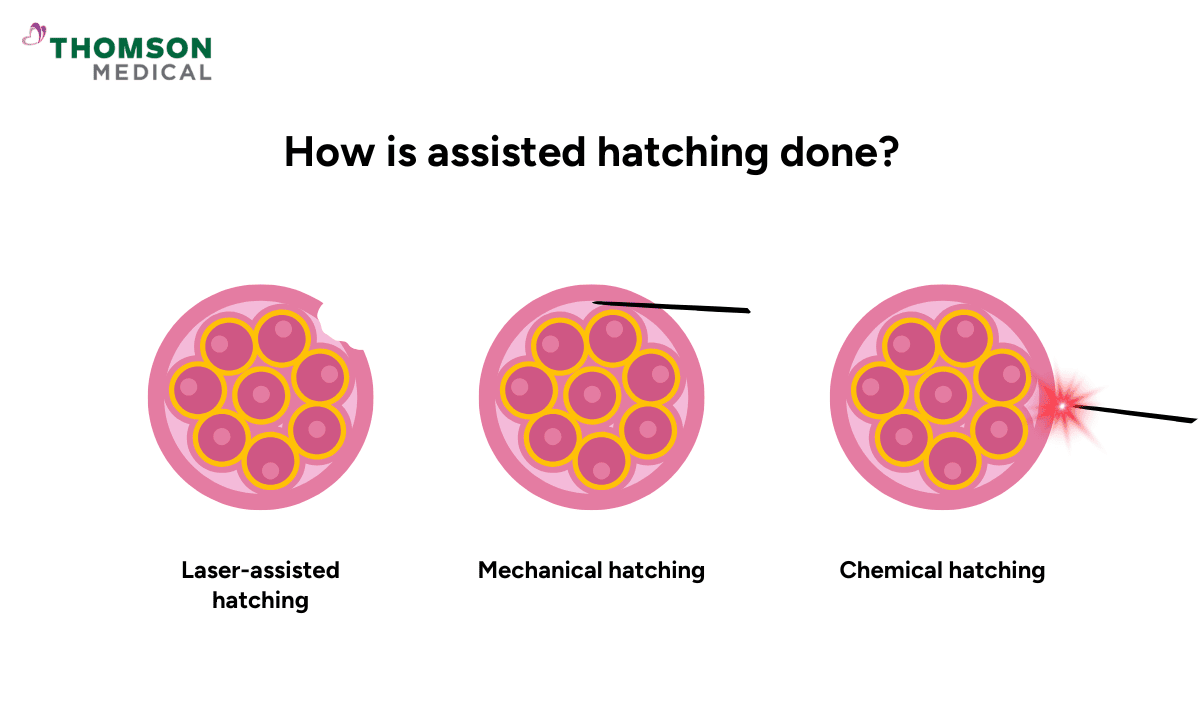 How is assisted hatching done