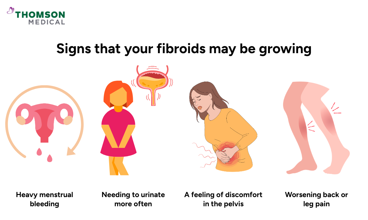 Illustration on signs that your fibroids may be growing