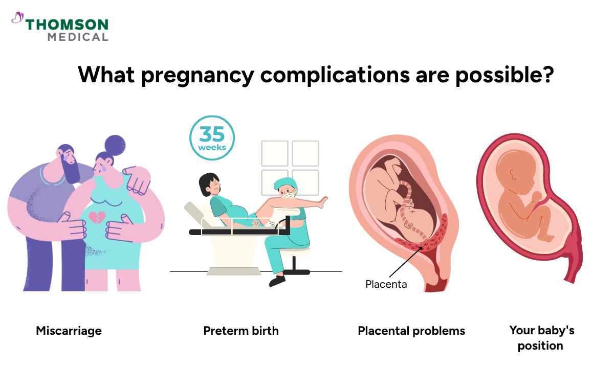 Illustration shows the possible pregnancy complication if you are having fibroids