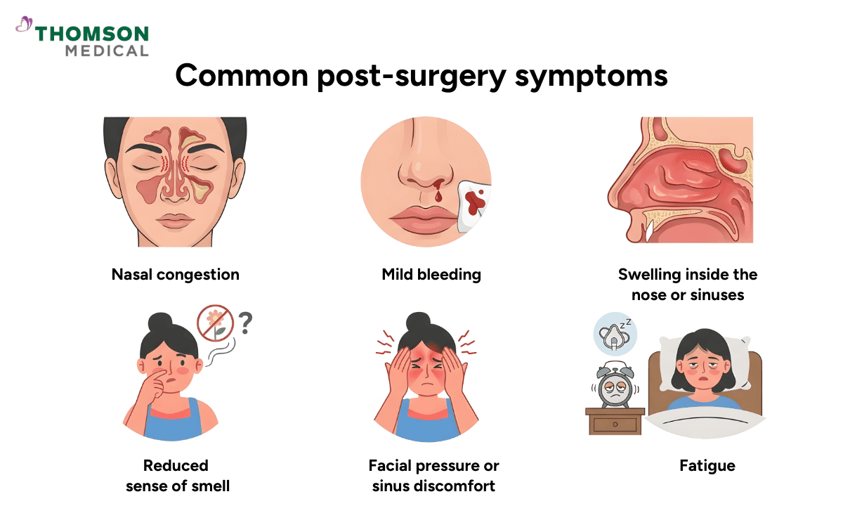 Infographic on common post-surgery symptoms, showing nasal congestion, mild bleeding, internal swelling, reduced sense of smell, facial pressure/sinus discomfort, and fatigue.