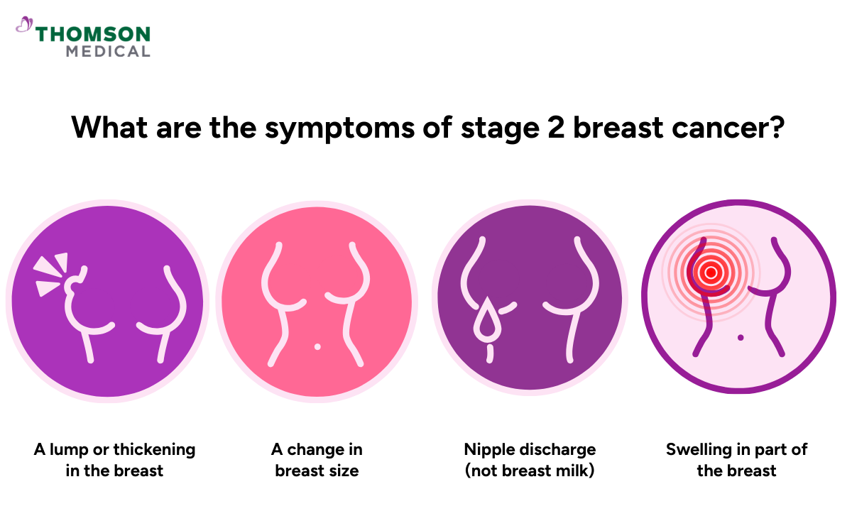 Illustration of the symptoms of stage 2 breast cancer